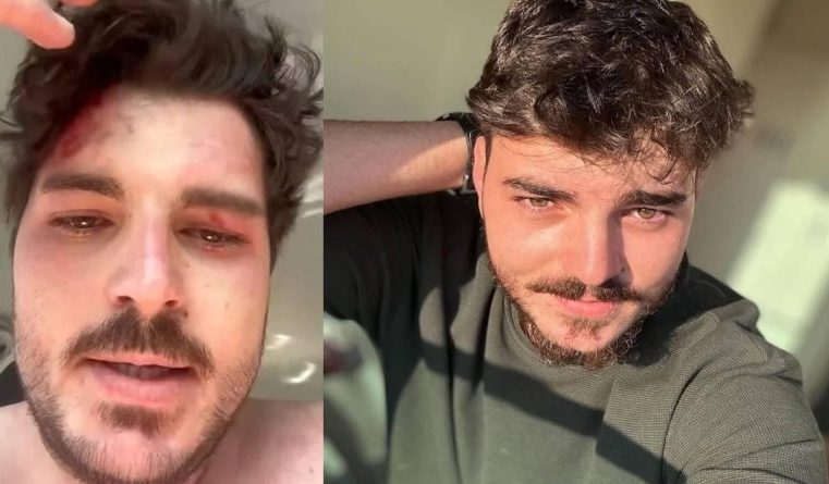 Dizi oyuncusu ne hale geldi