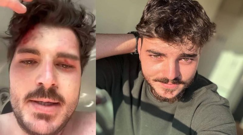 Dizi oyuncusu ne hale geldi