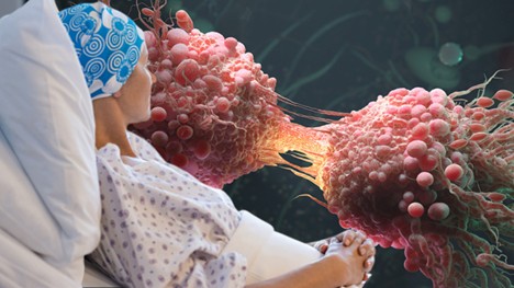 Dünyada 20 Milyon Türkiye de 240 Bin Tanı