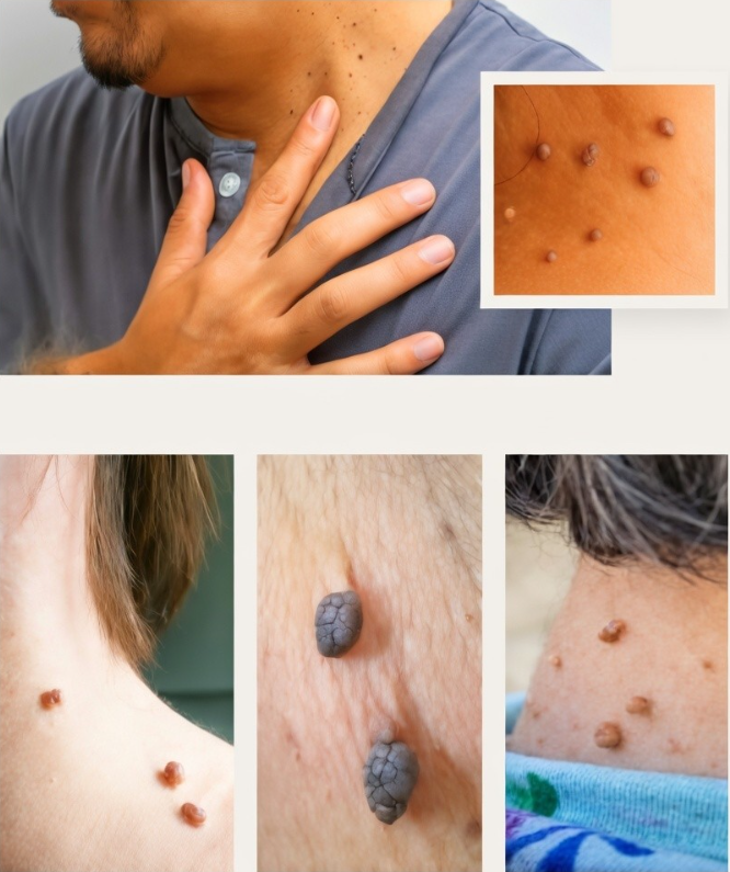 Et Benlerini Patır Patır Döken Tarifler