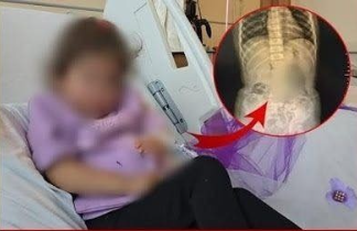 4 Yaşındaki Küçük Kızın