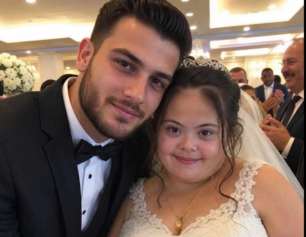 ARKADAŞIM DOWN SENDROMLU KIZ KARDEŞİMLE EVLENDİ