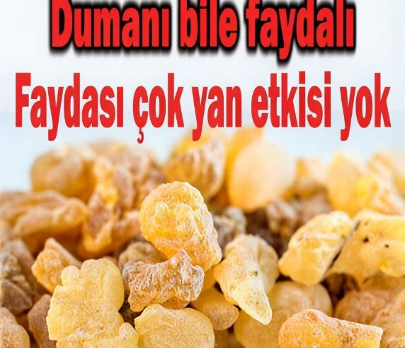 Bacak Ağrısı Romatizma, Varis ve Artrit Ağrılarına Birebir